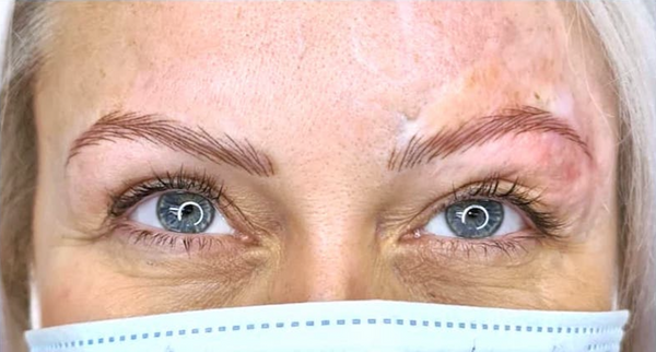 Tina Davies Professional Case Study: Nanobrows and Tattooing with Scarring