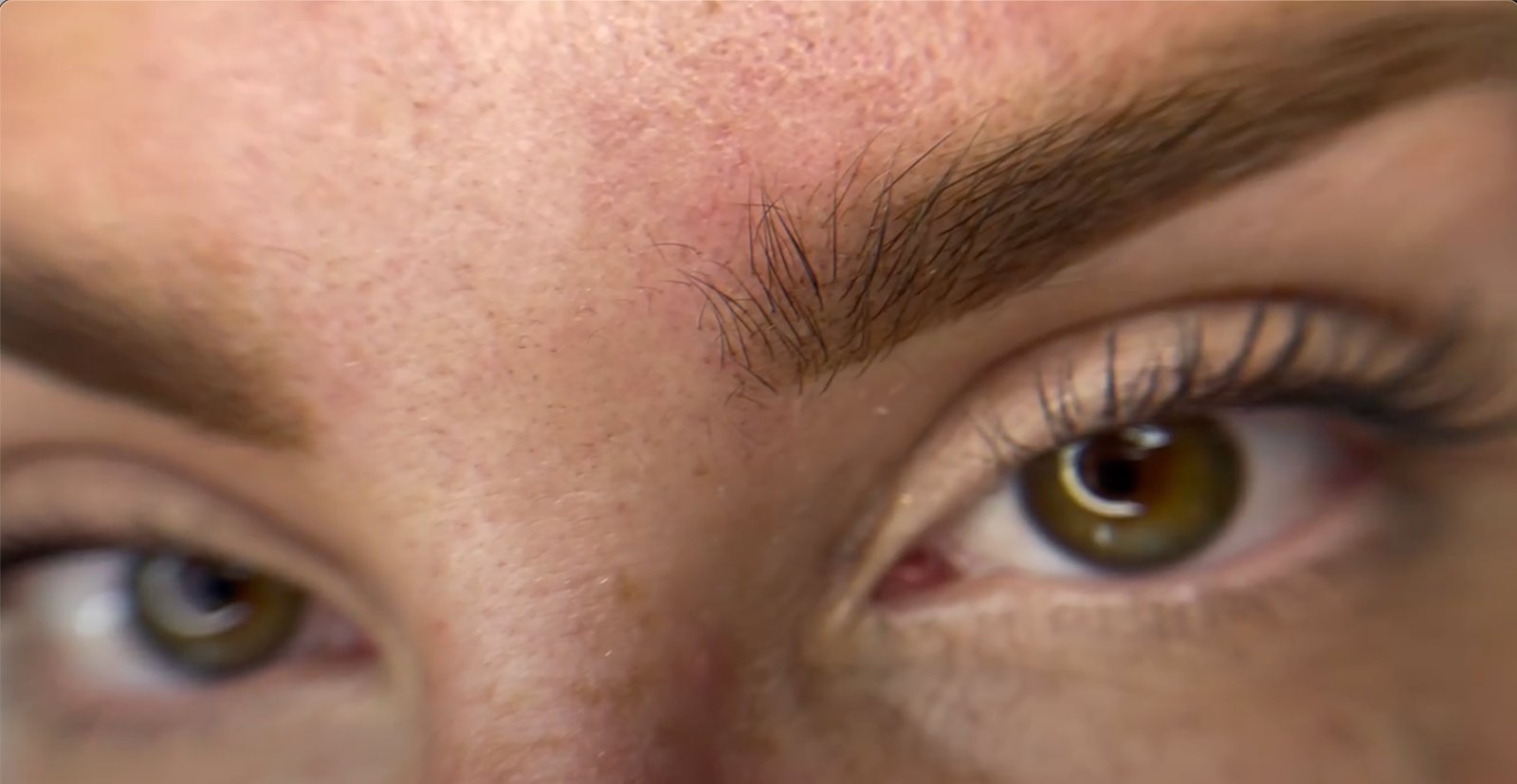 The Most Overlooked Factor in PMU: The Skin, image size:1600x827