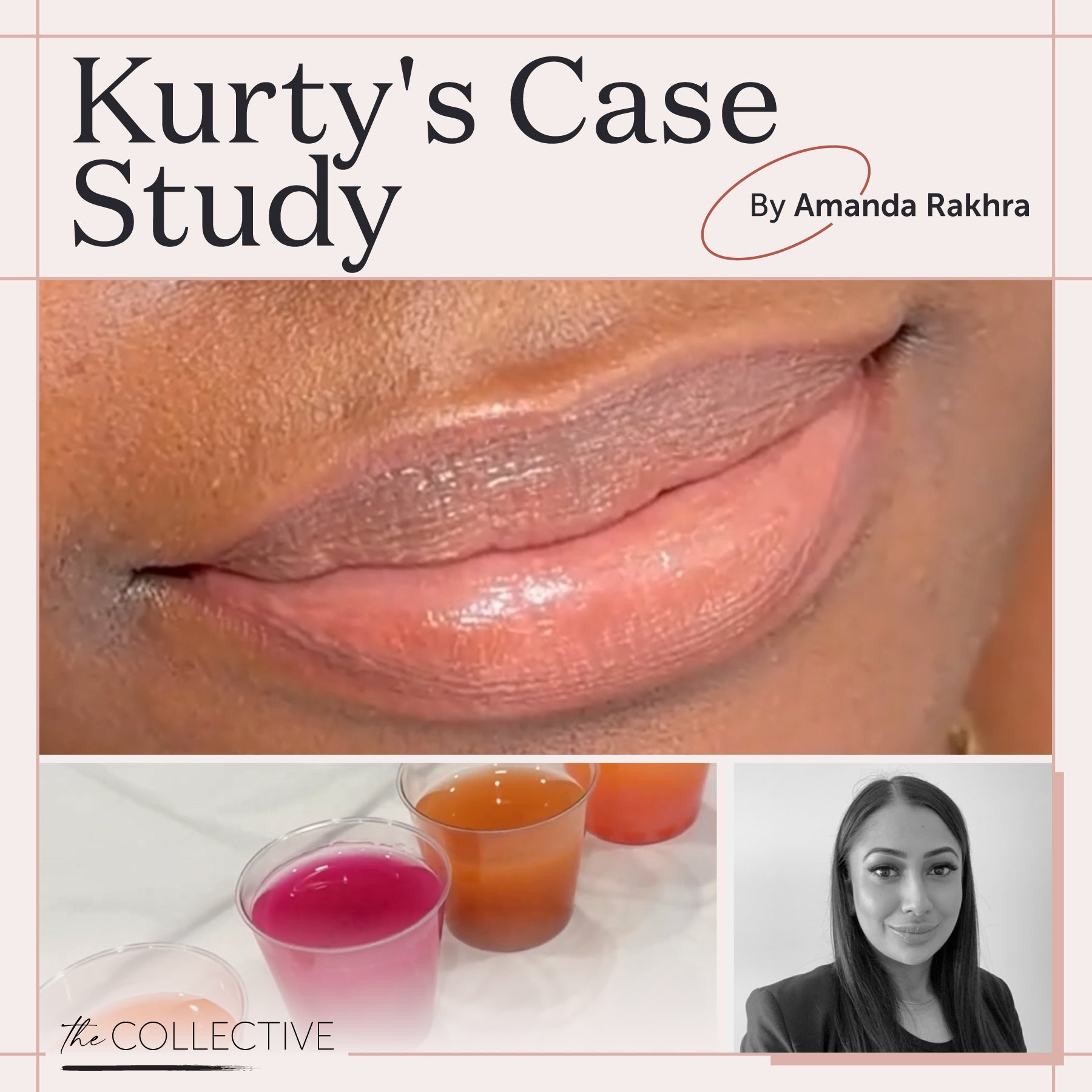 Fitz 6 Dark Lip Neutralization: Kurty’s Case Study - Tina Davies Professional