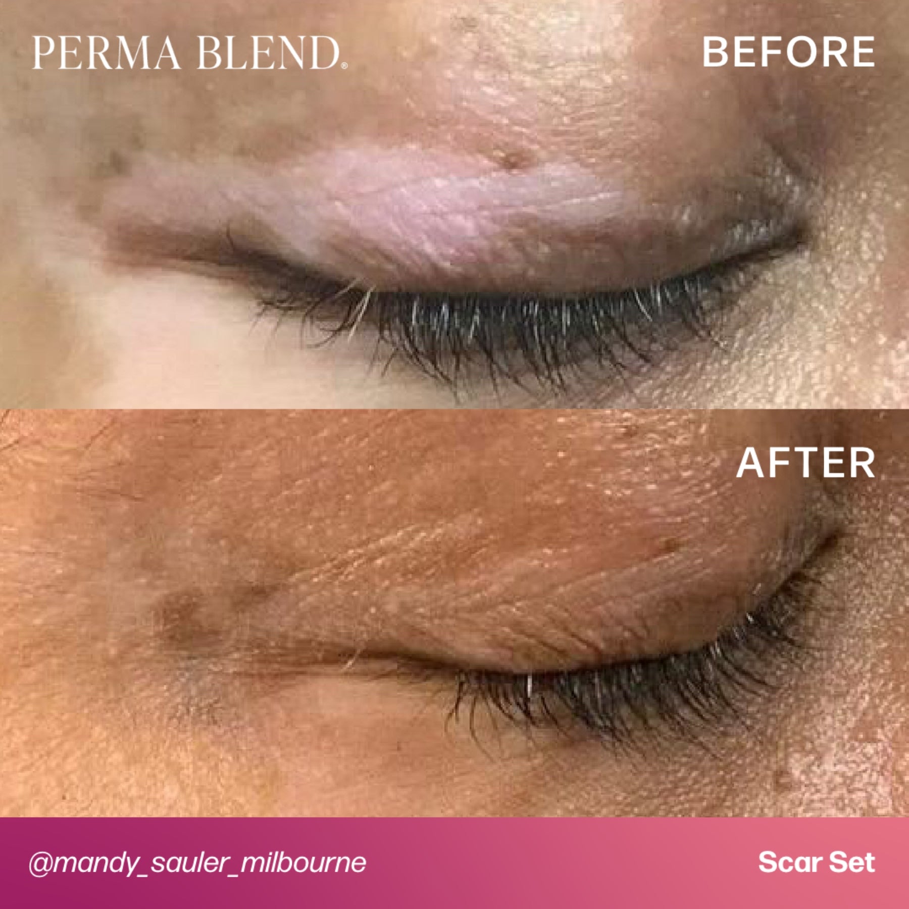 Perma Blend Scar Pigment Set - Tina Davies Professional