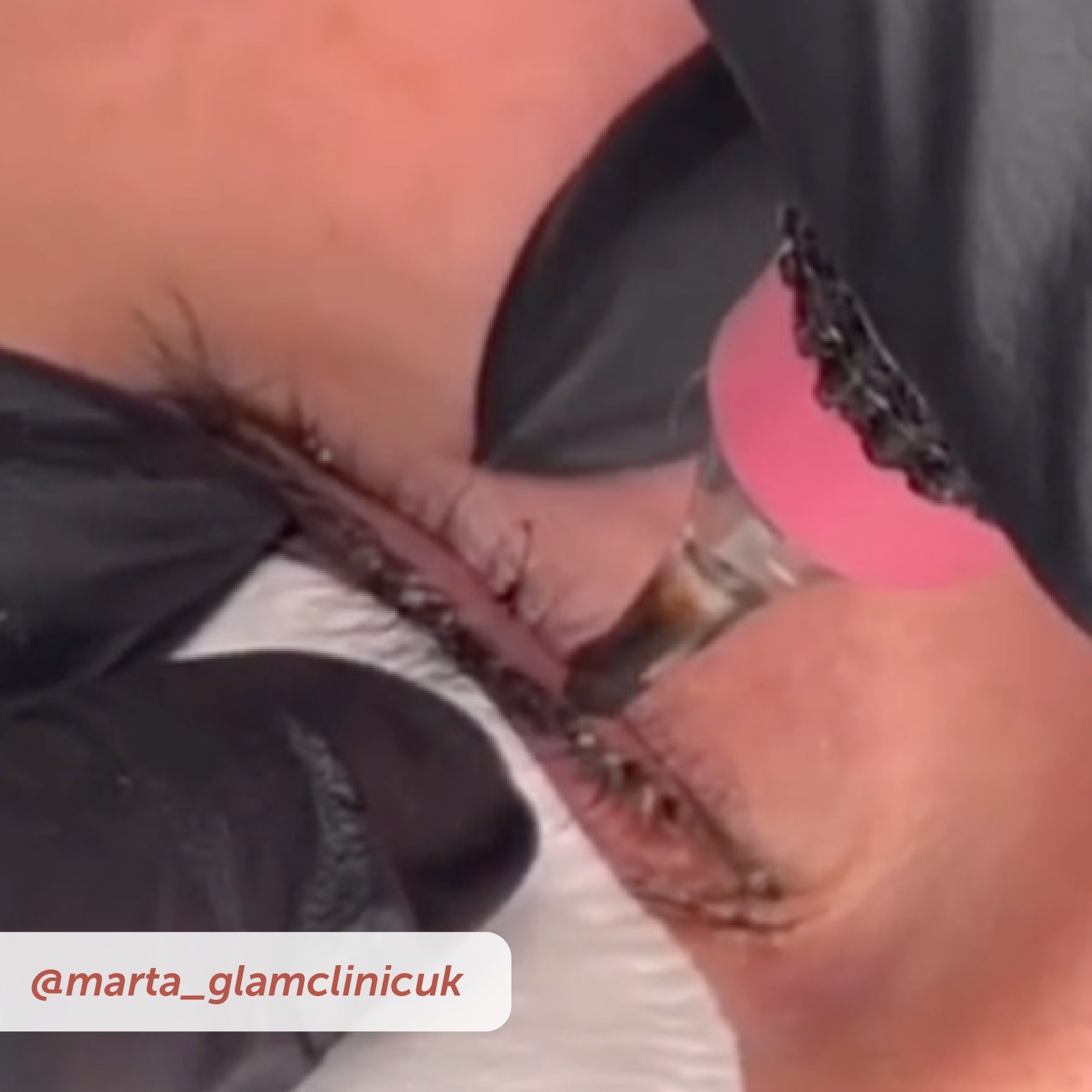 PIXL Needle Cartridges - Tina Davies Professional