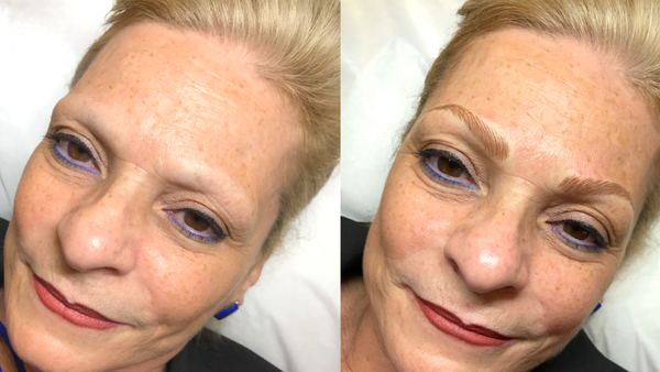 Case Study 2: Microblading for Denise