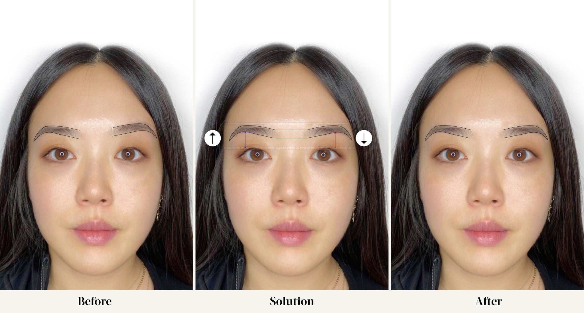Case Study: Brow Mapping for Eyebrow Axis Imbalance – Tina Davies ...