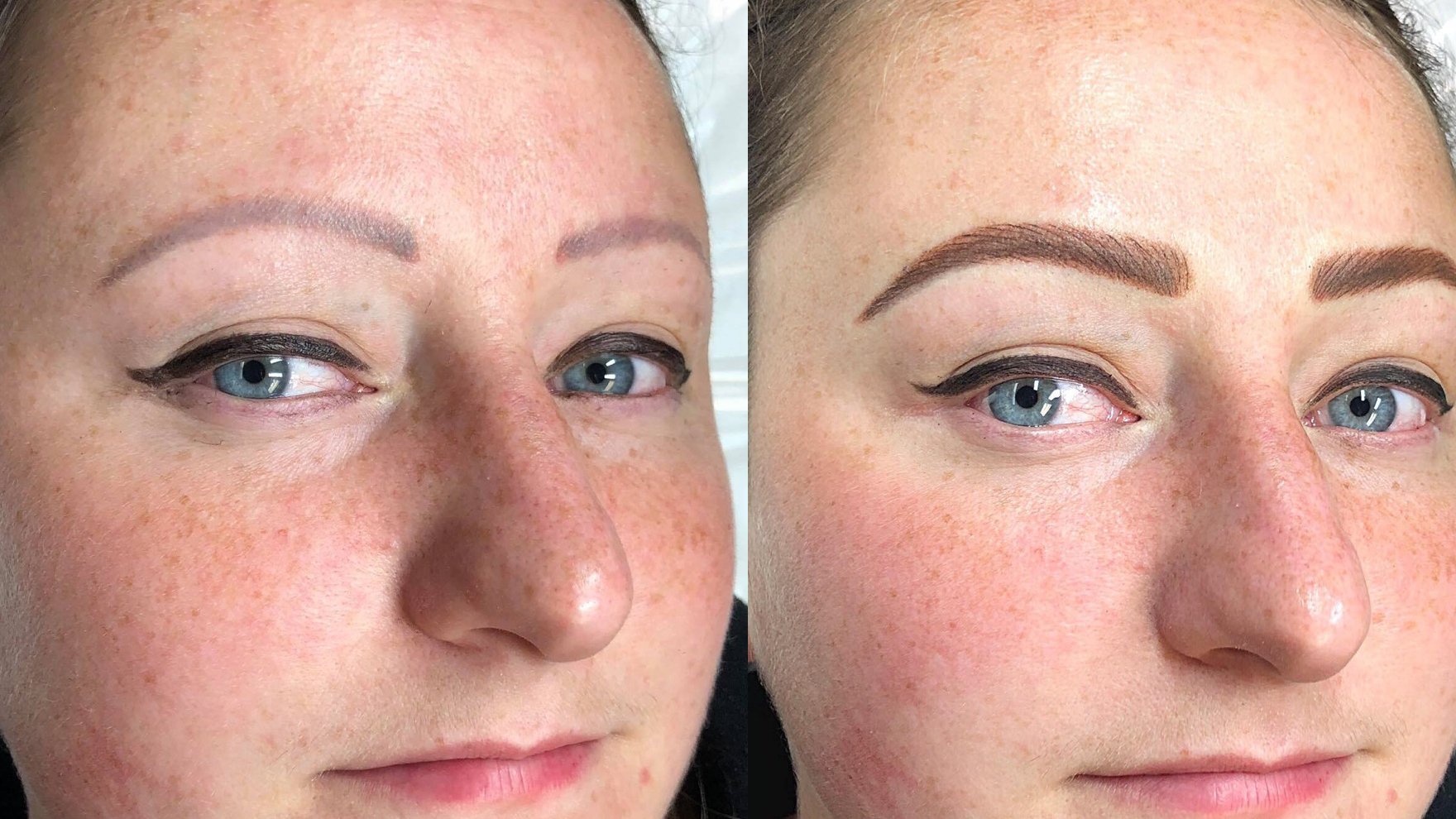 Case Study 7: Trichotillomania correction - Tina Davies Professional