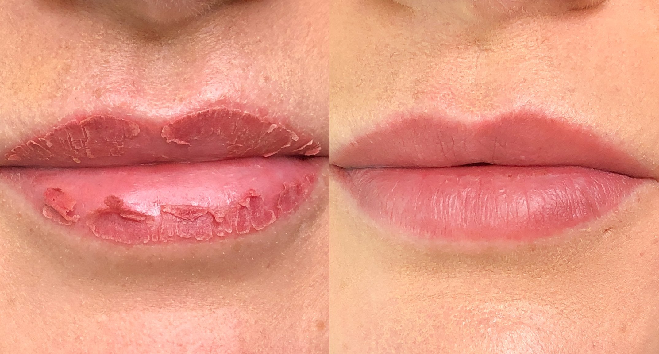 Lip Blush Healing Day by Day - Tina Davies Professional