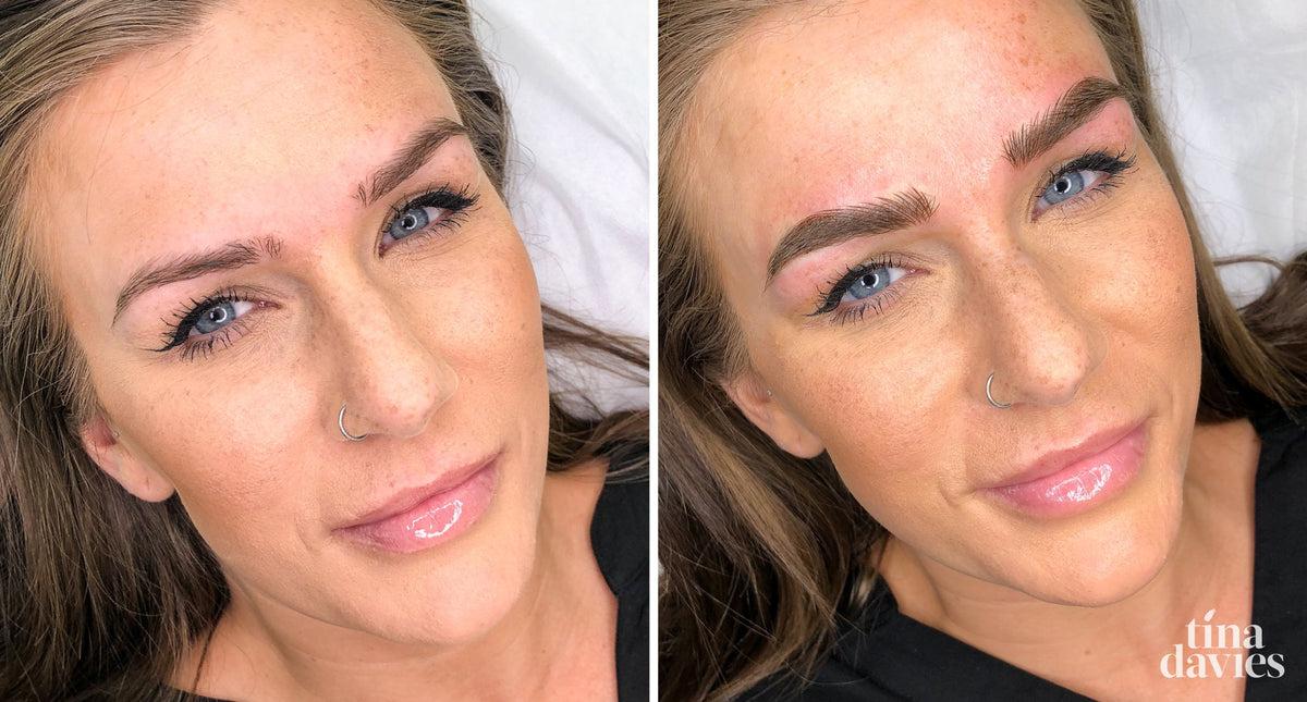 Combo Brows Infected My Combo Brows Healing Day by Day