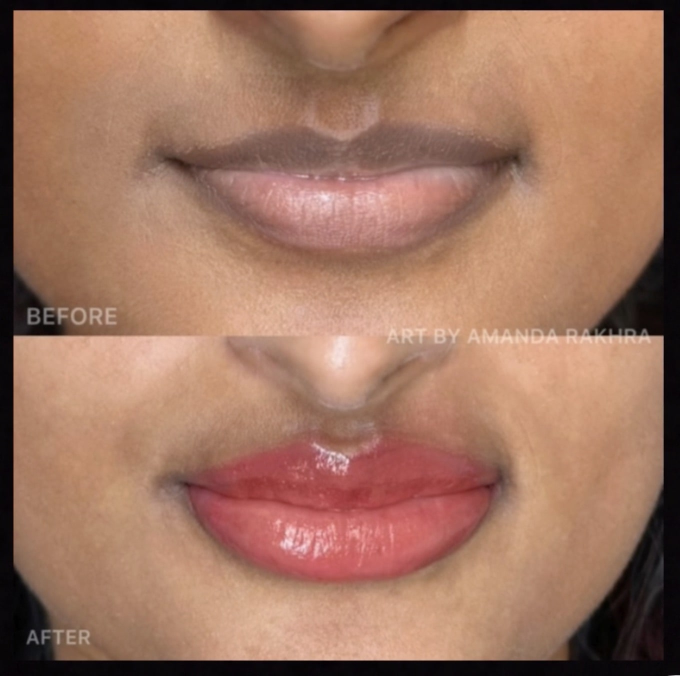 Fitz 5 Dark Lip Neutralization: Anita's Case Study by Amanda Rakhra - Tina Davies Professional