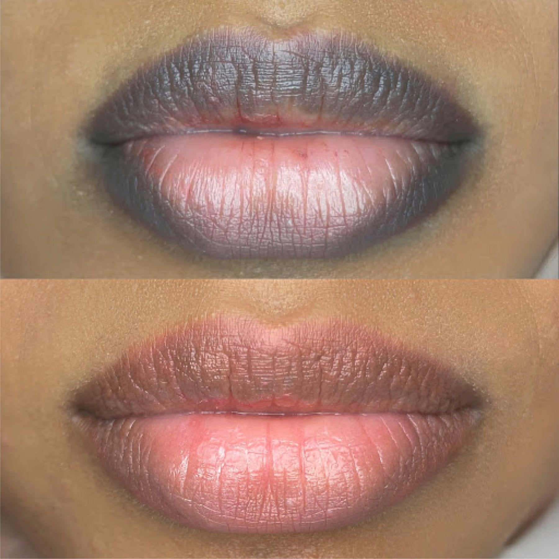 Lip Magic: Dark Lip Neutralization - Tina Davies Professional