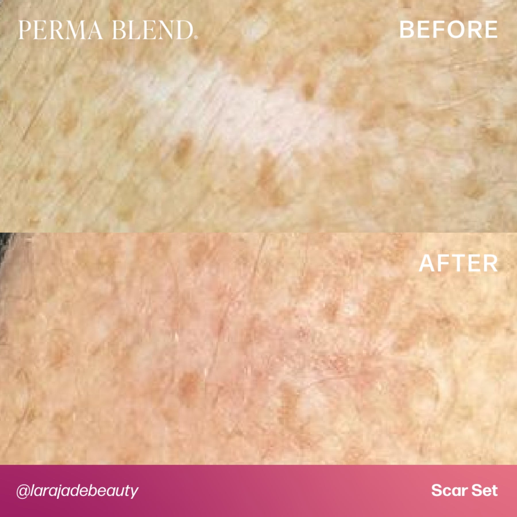 Perma Blend Scar Pigment Set - Tina Davies Professional