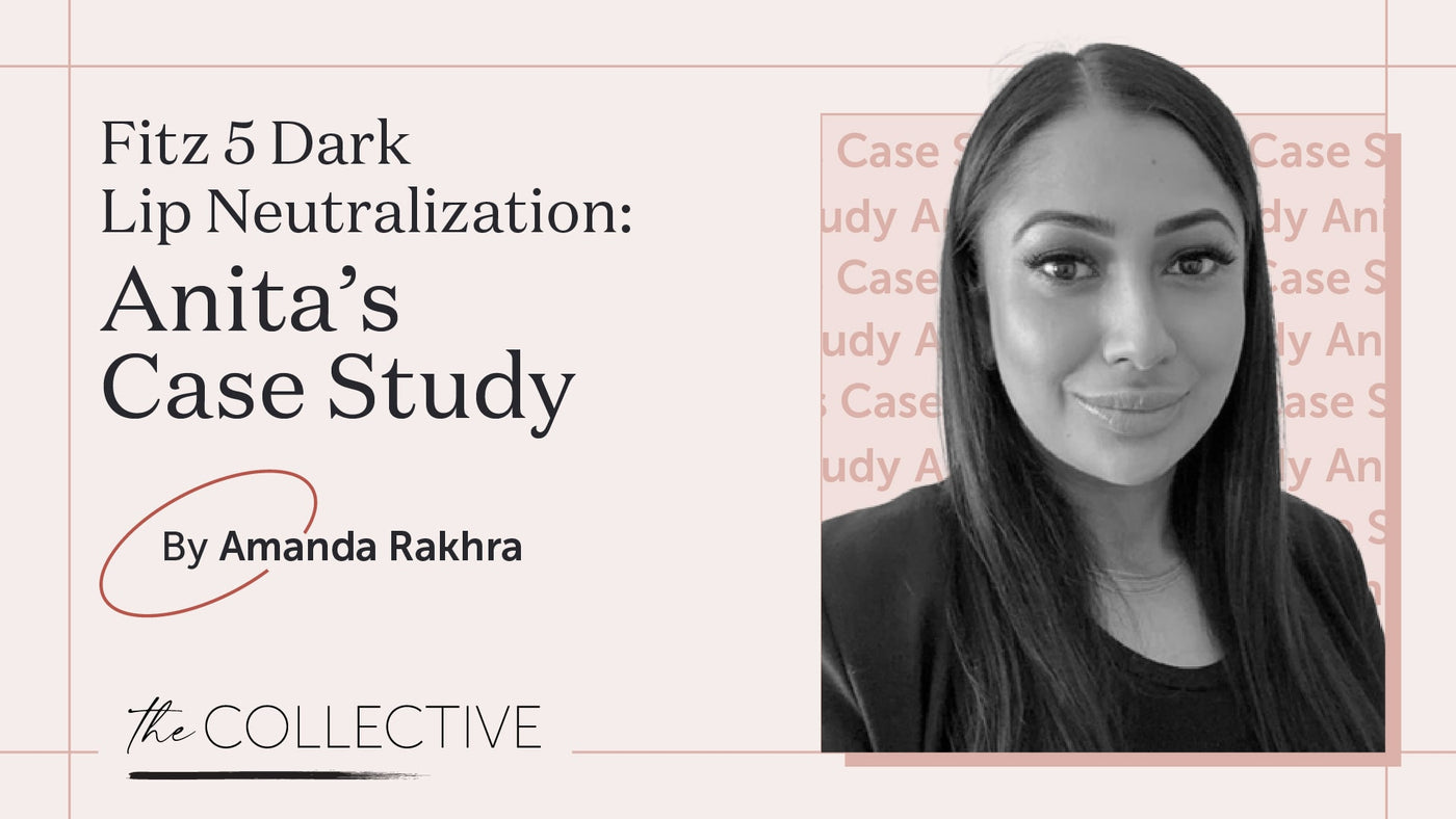 Fitz 5 Dark Lip Neutralization Case Study by Amanda Rakhra